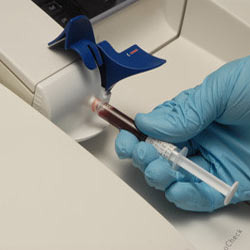 Blood Gases – EmergencyPedia