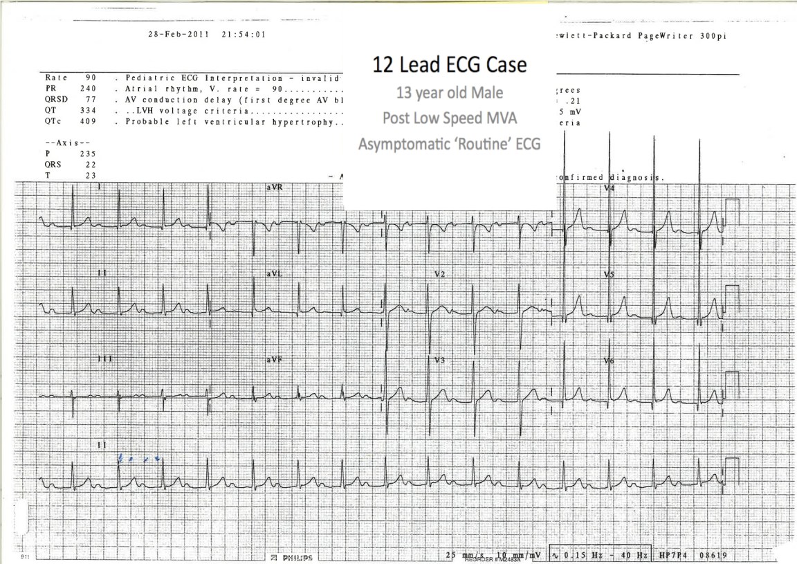 A Repeat ECG - the patient remains asymptomatic
