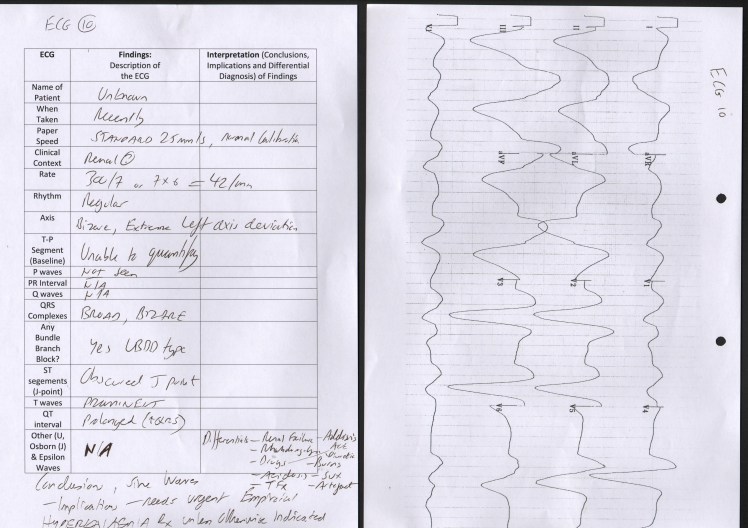 A 60 year old male patient presenting with Syncope pre-dialysis
