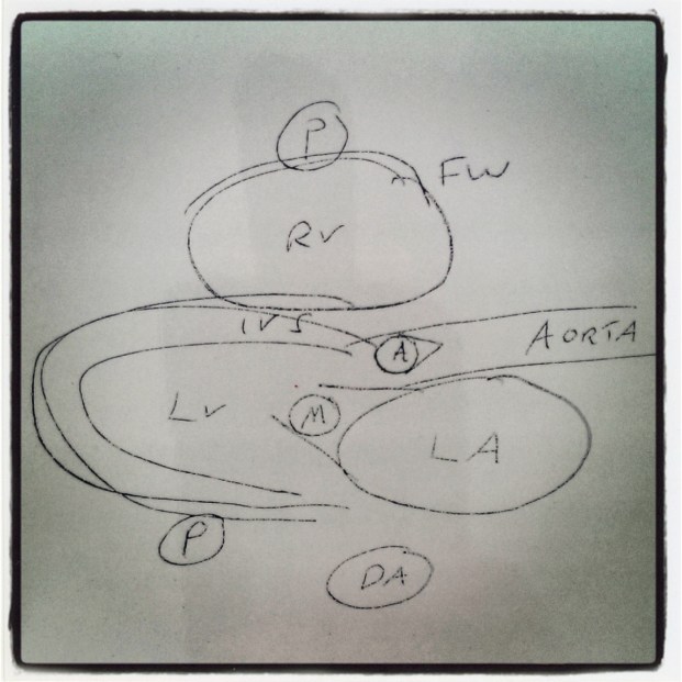 PLAX - Sketch of Anatomy