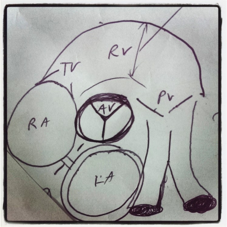 PSAX - Superior View (USS Beam Angulated towards head)