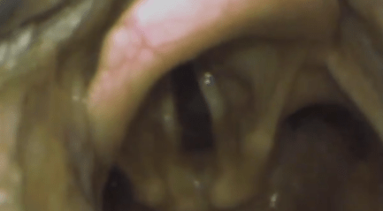 Lift to reveal cords