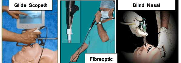 Advanced Intubation Techniques