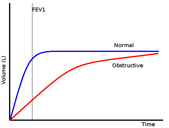 330x250xobstructive.png.pagespeed.ic.LsnU75DB0T