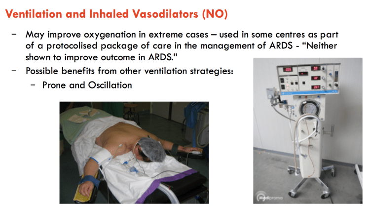 Screen Shot 2016-03-30 at 11.04.03 PM