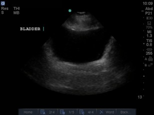 FAST Scan - Normal Pelvis.jpg